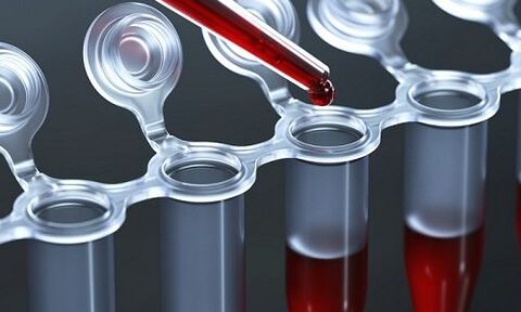 Proba de sangue para varices nas pernas